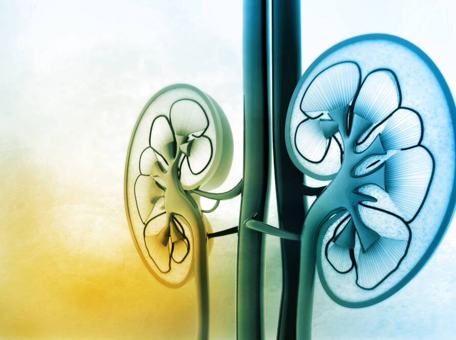 Without monitoring from a kidney specialist, diabetes can lead to renal failure.