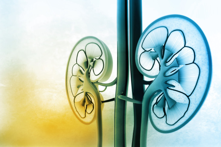 Without monitoring from a kidney specialist, diabetes can lead to renal failure.