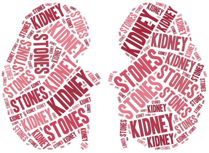 Kidney Doctor Jupiter FL - Learn more about symptoms of kidney stones, what causes kidney stones, and more